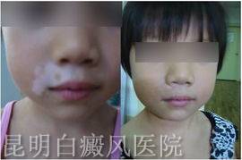 ����֢״����ж�