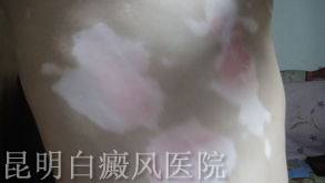 ���������֢״��ʲô